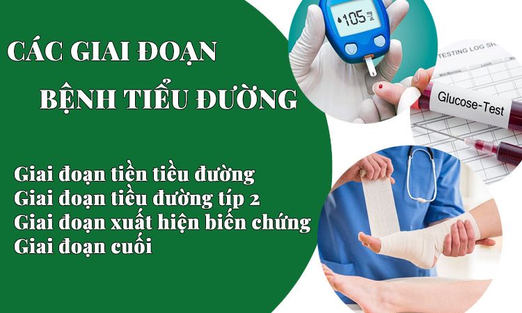 cac-giai-doan-benh-tieu-duong