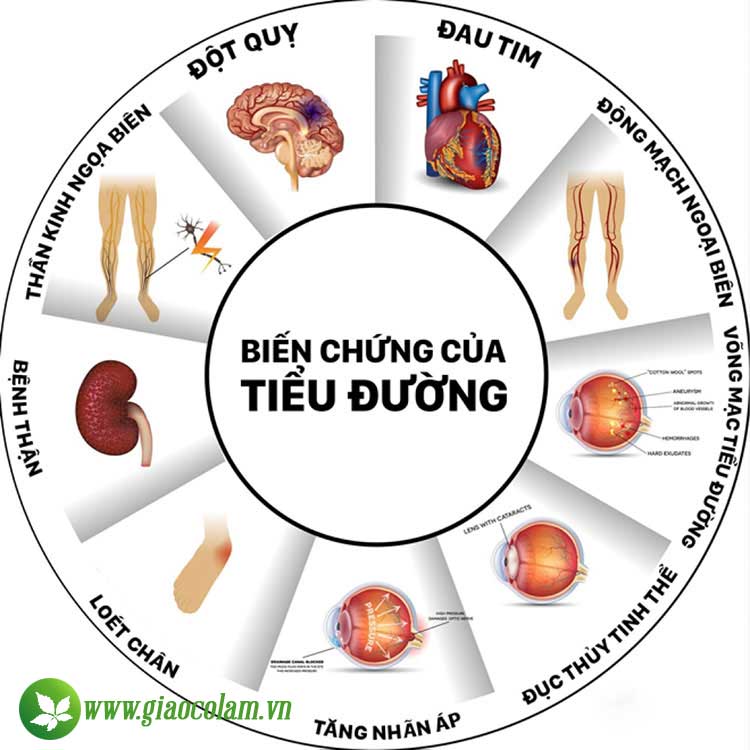 bien-chung-tieu-duong