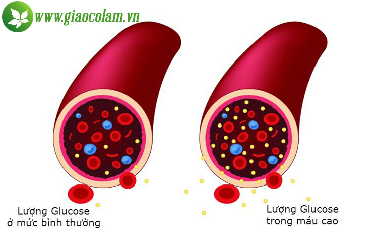 glucoge-mau-tang-cao